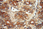 FMN2 Antibody in Immunohistochemistry (Paraffin) (IHC (P))