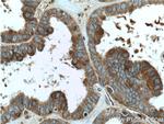 FMN2 Antibody in Immunohistochemistry (Paraffin) (IHC (P))