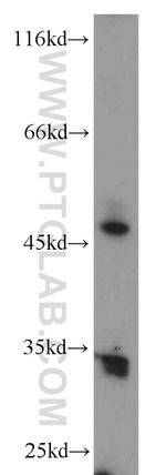 ERO1LB Antibody in Western Blot (WB)