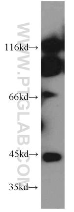 ERO1LB Antibody in Western Blot (WB)