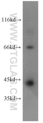 ERO1LB Antibody in Western Blot (WB)