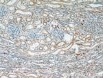 ATG3 Antibody in Immunohistochemistry (Paraffin) (IHC (P))