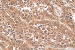 OCT4 Antibody in Immunohistochemistry (Paraffin) (IHC (P))