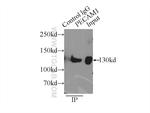 CD31 Antibody in Immunoprecipitation (IP)