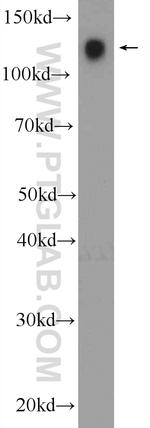 CD31 Antibody in Western Blot (WB)