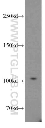 XRN2 Antibody in Western Blot (WB)