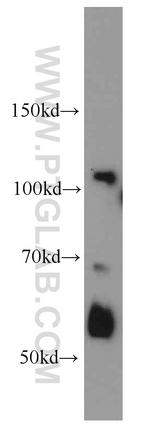 XRN2 Antibody in Western Blot (WB)