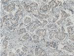 ASAH1 Antibody in Immunohistochemistry (Paraffin) (IHC (P))