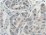 ASAH1 Antibody in Immunohistochemistry (Paraffin) (IHC (P))