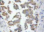 ASAH1 Antibody in Immunohistochemistry (Paraffin) (IHC (P))