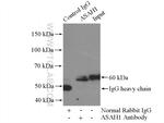 ASAH1 Antibody in Immunoprecipitation (IP)