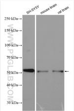 ASAH1 Antibody in Western Blot (WB)