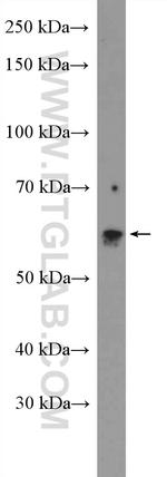 ASAH1 Antibody in Western Blot (WB)