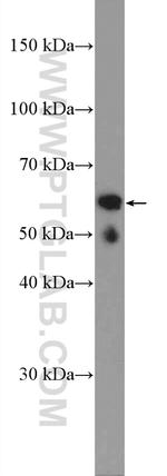 ASAH1 Antibody in Western Blot (WB)