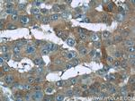 RMP Antibody in Immunohistochemistry (Paraffin) (IHC (P))