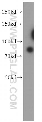 RMP Antibody in Western Blot (WB)