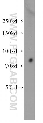 RMP Antibody in Western Blot (WB)