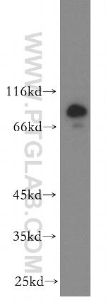 RMP Antibody in Western Blot (WB)