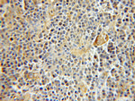 RMP Antibody in Immunohistochemistry (Paraffin) (IHC (P))