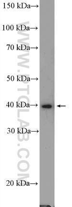 PRMT1 Antibody in Western Blot (WB)