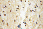 EIF4A2 Antibody in Immunohistochemistry (Paraffin) (IHC (P))