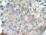 EIF4A2 Antibody in Immunohistochemistry (Paraffin) (IHC (P))