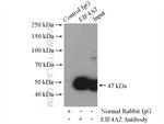 EIF4A2 Antibody in Immunoprecipitation (IP)