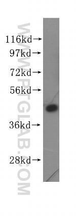 EIF4A2 Antibody in Western Blot (WB)