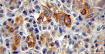 TMPRSS4 Antibody in Immunohistochemistry (Paraffin) (IHC (P))