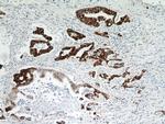 TMPRSS4 Antibody in Immunohistochemistry (Paraffin) (IHC (P))