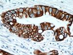 TMPRSS4 Antibody in Immunohistochemistry (Paraffin) (IHC (P))