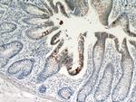 TMPRSS4 Antibody in Immunohistochemistry (Paraffin) (IHC (P))