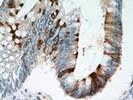 TMPRSS4 Antibody in Immunohistochemistry (Paraffin) (IHC (P))