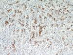 TMPRSS4 Antibody in Immunohistochemistry (Paraffin) (IHC (P))