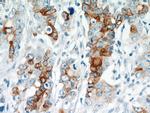 TMPRSS4 Antibody in Immunohistochemistry (Paraffin) (IHC (P))