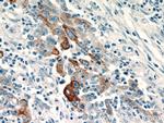 TMPRSS4 Antibody in Immunohistochemistry (Paraffin) (IHC (P))