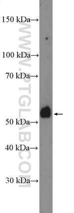 TMPRSS4 Antibody in Western Blot (WB)