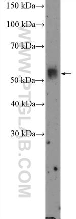 TMPRSS4 Antibody in Western Blot (WB)