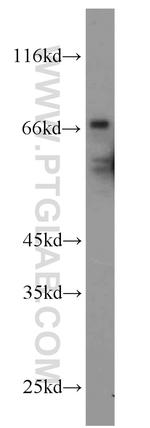 RNF156 Antibody in Western Blot (WB)