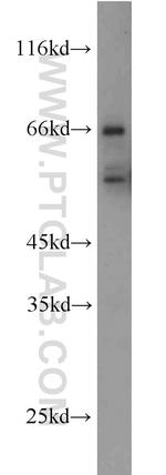 RNF156 Antibody in Western Blot (WB)