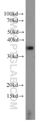 EIF3I Antibody in Western Blot (WB)