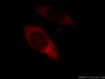 EIF3I Antibody in Immunocytochemistry (ICC/IF)