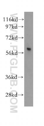 PARP3 Antibody in Western Blot (WB)