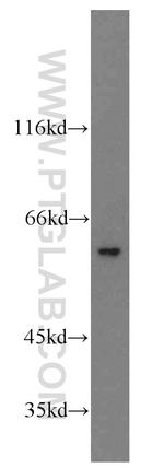 PARP3 Antibody in Western Blot (WB)