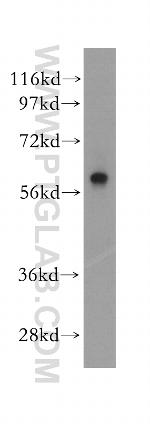PARP3 Antibody in Western Blot (WB)