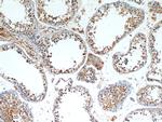 ALR Antibody in Immunohistochemistry (Paraffin) (IHC (P))