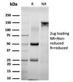 NACC1/Nac1/BTBD14B Antibody in SDS-PAGE (SDS-PAGE)