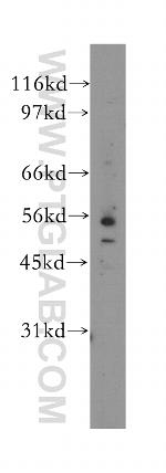 EIF2B3 Antibody in Western Blot (WB)