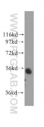 TADA2L Antibody in Western Blot (WB)