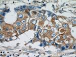 HARS2 Antibody in Immunohistochemistry (Paraffin) (IHC (P))